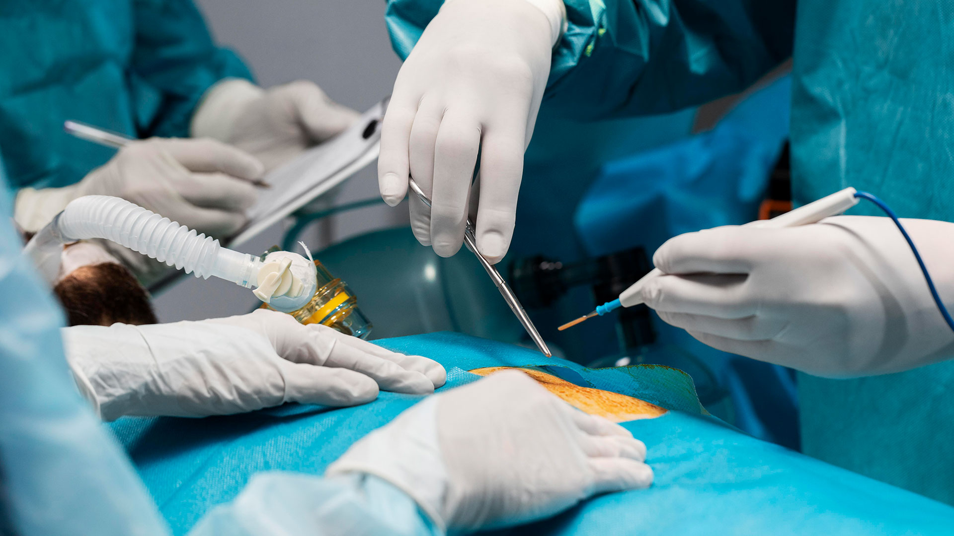 TAVI: An Alternative to Open-Heart Surgery in India