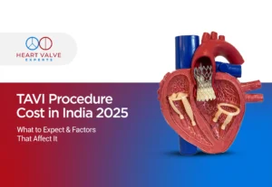 tavi procedure cost in india