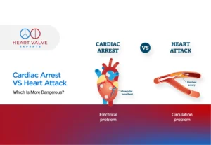 Cardiac Arrest vs Heart Attack: Which Is More Dangerous? Cardiac arrest vs heart attack