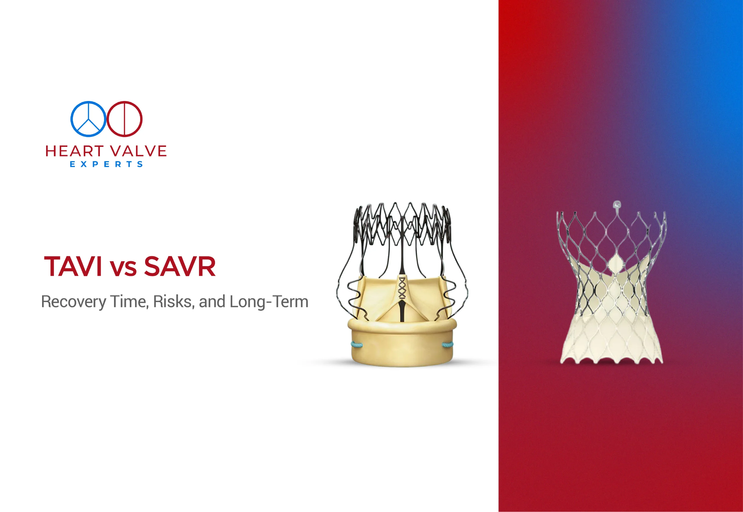 TAVI vs SAVR: Recovery, Risks, and Long-Term Results